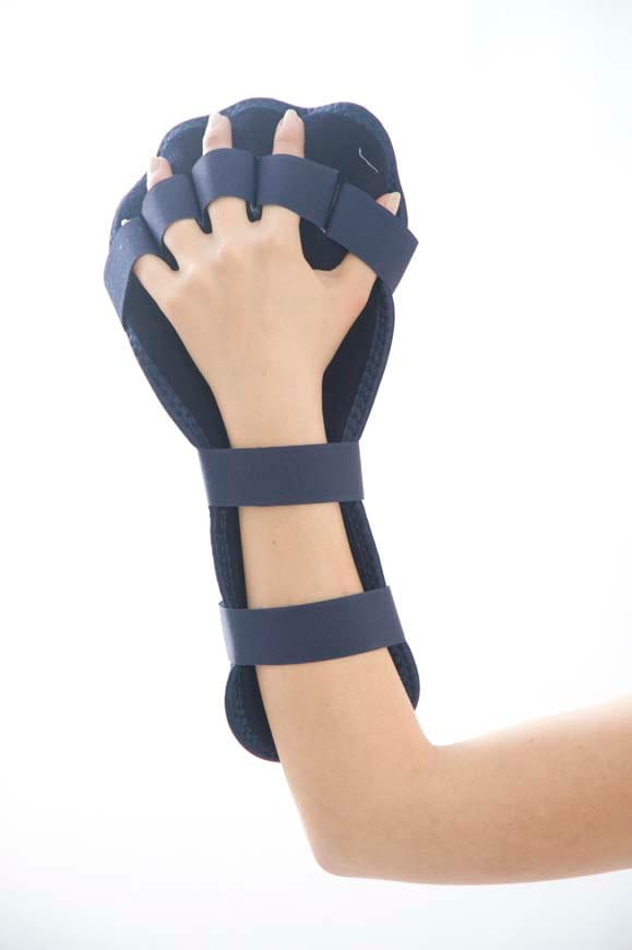 Static Hand Wrist Finger Orthesis - Image 2
